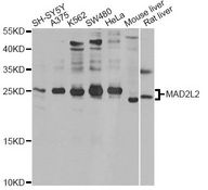 MAD2B / REV7 Antibody - Western blot analysis of extracts of various cell lines, using MAD2L2 antibody at 1:1000 dilution. The secondary antibody used was an HRP Goat Anti-Rabbit IgG (H+L) at 1:10000 dilution. Lysates were loaded 25ug per lane and 3% nonfat dry milk in TBST was used for blocking. An ECL Kit was used for detection and the exposure time was 5s.