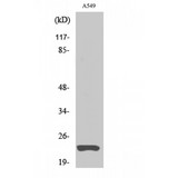 MAD2L1 / MAD2 Antibody - Western blot of MAD2 antibody