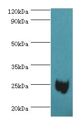 MAD2L1 / MAD2 Antibody - Western blot. All lanes: Mitotic spindle assembly checkpoint protein MAD2A antibody at 3 ug/ml+293T whole cell lysate. Secondary antibody: Goat polyclonal to rabbit at 1:10000 dilution. Predicted band size: 24 kDa. Observed band size: 24 kDa.