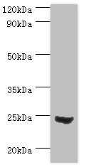 MAD2L1 / MAD2 Antibody - Western blot All lanes: Mitotic spindle assembly checkpoint protein MAD2A antibody at 3µg/ml + 293T whole cell lysate Secondary Goat polyclonal to rabbit IgG at 1/10000 dilution Predicted band size: 24, 11 kDa Observed band size: 24 kDa