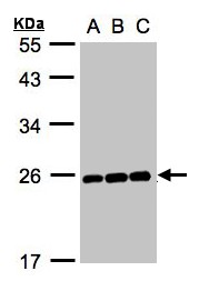 MAD2L1 / MAD2 Antibody - Sample (30g whole cell lysate). A: Hep G2 , B: MOLT4 , C: Raji . 12% SDS PAGE. MAD2L1 / MAD2 antibody diluted at 1:1000