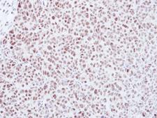 MAD2L1 / MAD2 Antibody - IHC of paraffin-embedded DLD-1 xenograft using Mad2L1 antibody at 1:500 dilution.