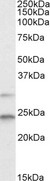 MAD2L1 / MAD2 Antibody - Goat Anti-MAD2L1 Antibody (2µg/ml) staining of HEK293 lysate (35µg protein in RIPA buffer). Primary incubation was 1 hour. Detected by chemiluminescencence.