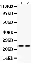 MAD2L1 / MAD2 Antibody - Mad2L1 antibody Western blot. All lanes: Anti Mad2L1 at 0.5 ug/ml. Lane 1: 293T Whole Cell Lysate at 40 ug. Lane 2: COLO320 Whole Cell Lysate at 40 ug. Predicted band size: 23 kD. Observed band size: 23 kD.