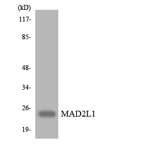 MAD2L1 / MAD2 Antibody - Western blot analysis of the lysates from HUVECcells using MAD2L1 antibody.