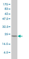 MAD2L1 / MAD2 Antibody - MAD2L1 monoclonal antibody (M01), clone 2E2-1D6 Western Blot analysis of MAD2L1 expression in HeLa.