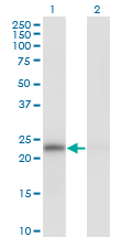 MAD2L1 / MAD2 Antibody - Western Blot analysis of MAD2L1 expression in transfected 293T cell line by MAD2L1 monoclonal antibody (M01), clone 2E2-1D6.Lane 1: MAD2L1 transfected lysate(23.5 KDa).Lane 2: Non-transfected lysate.