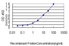 MAD2L1 / MAD2 Antibody - Detection limit for recombinant GST tagged MAD2L1 is approximately 0.03 ng/ml as a capture antibody.