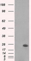 MAD2L1 / MAD2 Antibody - HEK293T cells were transfected with the pCMV6-ENTRY control (Left lane) or pCMV6-ENTRY MAD2L1 (Right lane) cDNA for 48 hrs and lysed. Equivalent amounts of cell lysates (5 ug per lane) were separated by SDS-PAGE and immunoblotted with anti-MAD2L1.
