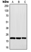 MAD2L1 / MAD2 Antibody - Western blot analysis of MAD2 expression in Raji (A); HepG2 (B); A431 (C) whole cell lysates.