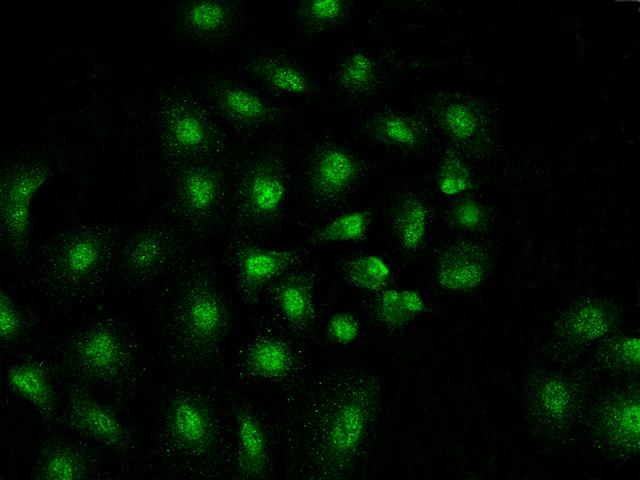 MAD2L1 / MAD2 Antibody - Immunofluorescence staining of MAD2L1 in A549 cells. Cells were fixed with 4% PFA, permeabilzed with 0.3% Triton X-100 in PBS, blocked with 10% serum, and incubated with rabbit anti-Human MAD2L1 polyclonal antibody (dilution ratio 1:200) at 4°C overnight. Then cells were stained with the Alexa Fluor 488-conjugated Goat Anti-rabbit IgG secondary antibody (green). Positive staining was localized to Nucleus.