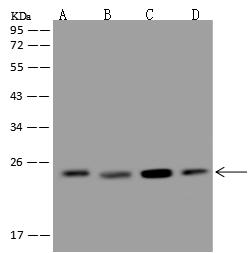 MAD2L1 / MAD2 Antibody - Anti-MAD2L1 rabbit polyclonal antibody at 1:500 dilution. Lane A: Hela Whole Cell Lysate. Lane B: A431 Whole Cell Lysate. Lane C: Jurkat Whole Cell Lysate. Lane D: HepG2 Whole Cell Lysate. Lysates/proteins at 30 ug per lane. Secondary: Goat Anti-Rabbit IgG (H+L)/HRP at 1/10000 dilution. Developed using the ECL technique. Performed under reducing conditions. Predicted band size: 24 kDa. Observed band size: 24 kDa.