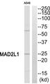 MAD2L1 / MAD2 Antibody - Western blot analysis of extracts from A549 cells, using MAD2L1 antibody.