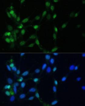 MAD2L1 / MAD2 Antibody - Immunofluorescence analysis of NIH/3T3 cells using MAD2L1 Polyclonal Antibody at dilution of 1:100 (40x lens).Blue: DAPI for nuclear staining.