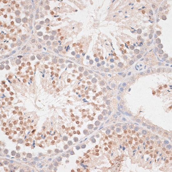 MAD2L1 / MAD2 Antibody - Immunohistochemistry of paraffin-embedded Mouse testis using MAD2L1 Polyclonal Antibody at dilution of 1:100 (40x lens).