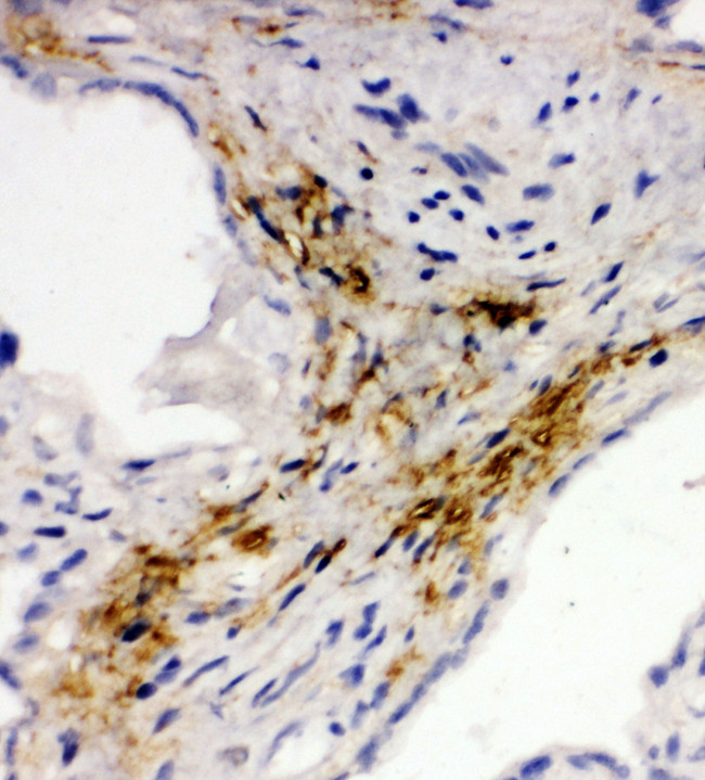 MAdCAM-1 Antibody - MADCAM1 / MAdCAM-1 antibody. IHC(F): Human Placenta Tissue.