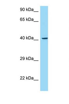 MAdCAM-1 Antibody - MADCAM1 / MAdCAM-1 antibody Western blot of 435S Cell lysate. Antibody concentration 1 ug/ml.  This image was taken for the unconjugated form of this product. Other forms have not been tested.