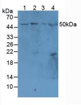 MAdCAM-1 Antibody - Western Blot; Sample: Lane1: Mouse Spleen Tissue; Lane2: Mouse Intestine Tissue; Lane3: Mouse Brain Tissue; Lane4: Mouse Liver Tissue.