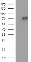 MAdCAM-1 Antibody - HEK293T cells were transfected with the pCMV6-ENTRY control (Left lane) or pCMV6-ENTRY MADCAM1 (Right lane) cDNA for 48 hrs and lysed. Equivalent amounts of cell lysates (5 ug per lane) were separated by SDS-PAGE and immunoblotted with anti-MADCAM1.