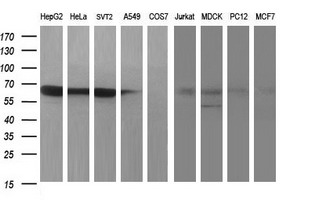 MAdCAM-1 Antibody - Western blot of extracts (35ug) from 9 different cell lines by using anti-MADCAM1 monoclonal antibody (HepG2: human; HeLa: human; SVT2: mouse; A549: human; COS7: monkey; Jurkat: human; MDCK: canine; PC12: rat; MCF7: human).