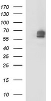 MAdCAM-1 Antibody - HEK293T cells were transfected with the pCMV6-ENTRY control (Left lane) or pCMV6-ENTRY MADCAM1 (Right lane) cDNA for 48 hrs and lysed. Equivalent amounts of cell lysates (5 ug per lane) were separated by SDS-PAGE and immunoblotted with anti-MADCAM1.
