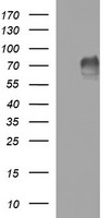 MAdCAM-1 Antibody - HEK293T cells were transfected with the pCMV6-ENTRY control (Left lane) or pCMV6-ENTRY MADCAM1 (Right lane) cDNA for 48 hrs and lysed. Equivalent amounts of cell lysates (5 ug per lane) were separated by SDS-PAGE and immunoblotted with anti-MADCAM1.