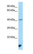 MAEA / EMP Antibody - MAEA / EMP antibody Western Blot of NCI-H226.  This image was taken for the unconjugated form of this product. Other forms have not been tested.