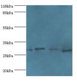 MAF1 Antibody - Western blot. All lanes: Repressor of RNA polymerase III transcription MAF1 homolog antibody at 2 ug/ml. Lane 1:MCF-7 whole cell lysate. Lane 2: PC-3 whole cell lysate. Lane 3: mouse kidney tissue. Lane 4: A431 whole cell lysate. Secondary antibody: Goat polyclonal to rabbit IgG.  This image was taken for the unconjugated form of this product. Other forms have not been tested.