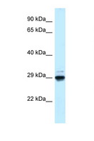 MAF1 Antibody - MAF1 antibody Western blot of Mouse Kidney lysate. Antibody concentration 1 ug/ml.  This image was taken for the unconjugated form of this product. Other forms have not been tested.