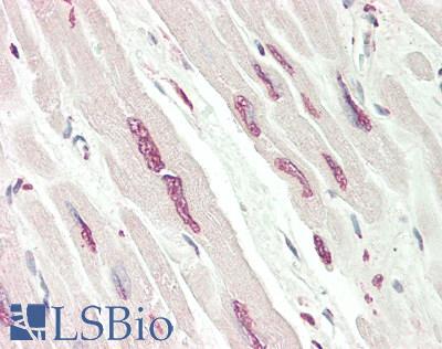 MAFB Antibody - Human Heart: Formalin-Fixed, Paraffin-Embedded (FFPE)