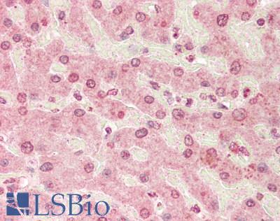 MAFB Antibody - Human Liver: Formalin-Fixed, Paraffin-Embedded (FFPE)