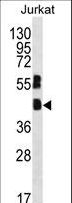 MAFB Antibody - MAFB Antibody western blot of Jurkat cell line lysates (35 ug/lane). The MAFB antibody detected the MAFB protein (arrow).
