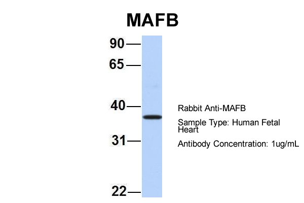 MAFB Antibody - MAFB antibody western blot of human fetal heart lysate. 
