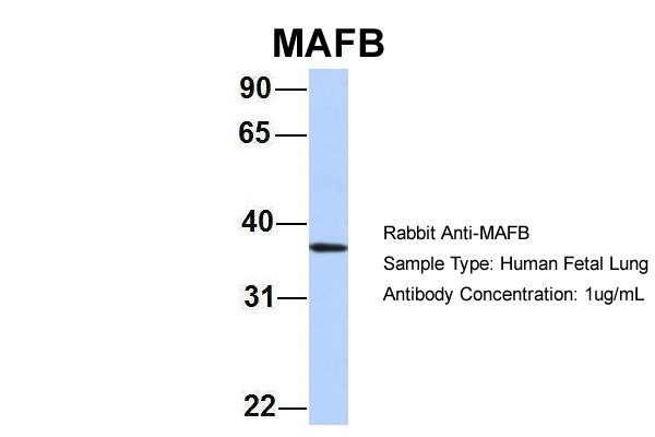 MAFB Antibody - MAFB antibody western blot of human fetal lung lysate. 