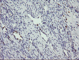 MAFB Antibody - IHC of paraffin-embedded Human Ovary tissue using anti-MAFB mouse monoclonal antibody. (Heat-induced epitope retrieval by 10mM citric buffer, pH6.0, 100C for 10min).