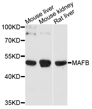 MAFB Antibody - Western blot analysis of extracts of various cell lines, using MAFB antibody at 1:1000 dilution. The secondary antibody used was an HRP Goat Anti-Rabbit IgG (H+L) at 1:10000 dilution. Lysates were loaded 25ug per lane and 3% nonfat dry milk in TBST was used for blocking. An ECL Kit was used for detection and the exposure time was 90s.