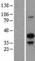 MAFB Protein - Western validation with an anti-DDK antibody * L: Control HEK293 lysate R: Over-expression lysate