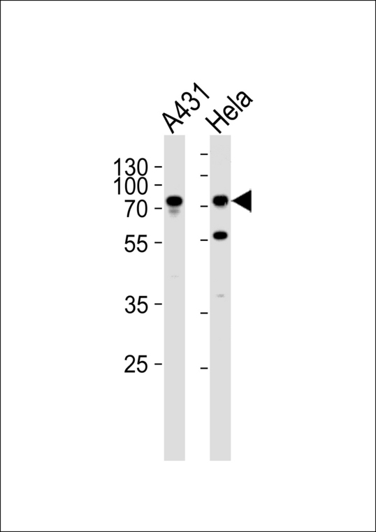 MAFK Antibody - Western blot of lysates from A431, HeLa cell line (from left to right), using SEPT9 Antibody. Antibody was diluted at 1:1000 at each lane. A goat anti-rabbit IgG H&L (HRP) at 1:5000 dilution was used as the secondary antibody. Lysates at 35ug per lane.