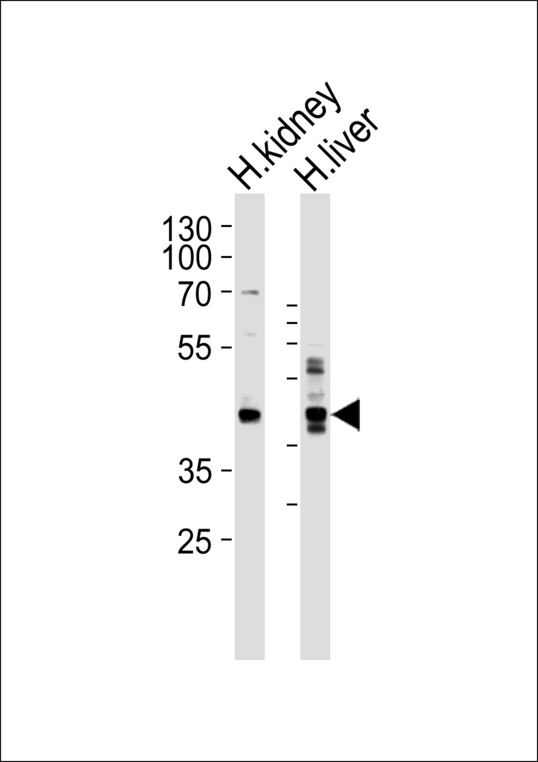 MAFK Antibody - Western blot of lysates from human kidney and liver tissue lysate (from left to right), using SEPT9 Antibody. Antibody was diluted at 1:1000 at each lane. A goat anti-rabbit IgG H&L (HRP) at 1:5000 dilution was used as the secondary antibody. Lysates at 35ug per lane.