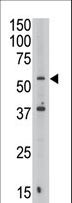 MAFK Antibody - The anti-SEPT9 antibody is used in Western blot to detect SEPT9 in Jurkat cell lysate.
