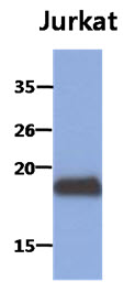 MAFK Antibody - Western Blot: The cell lysates of Jurkat (30 ug) were resolved by SDS-PAGE, transferred to PVDF membrane and probed with anti-human MAFK antibody (1:1000). Proteins were visualized using a goat anti-mouse secondary antibody conjugated to HRP and an ECL detection system.