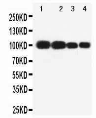 MAG Antibody - WB of MAG antibody. All lanes: Anti-MAG at 0.5ug/ml. Lane 1: Rat Brain Tissue Lysate at 40ug. Lane 2: Rat Brain Tissue Lysate at 40ug. Lane 3: Mouse Brain Tissue Lysate at 40ug. Lane 4: Mouse Brain Tissue Lysate at 40ug. Predicted bind size: 69KD. Observed bind size: 100KD.