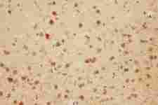 MAG Antibody - Anti-MAG antibody, IHC(P): Rat Brain Tissue