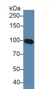 MAG Antibody - Western Blot; Sample: Human Serum; Primary Ab: 5µg/ml Rabbit Anti-Human MAG Antibody Second Ab: 0.2µg/mL HRP-Linked Caprine Anti-Rabbit IgG Polyclonal Antibody