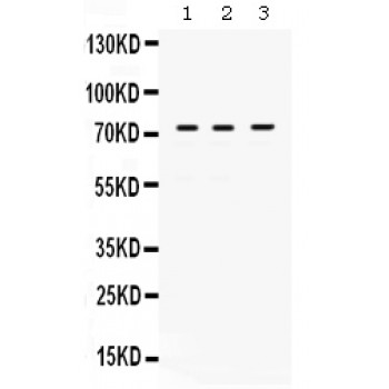MAG Antibody - MAG antibody Western blot. All lanes: Anti MAG at 0.5 ug/ml. Lane 1: 22RV1 Whole Cell Lysate at 40 ug. Lane 2: SW579 Whole Cell Lysate at 40 ug. Lane 3: A549 Whole Cell Lysate at 40 ug. Predicted band size: 72 kD. Observed band size: 72 kD.