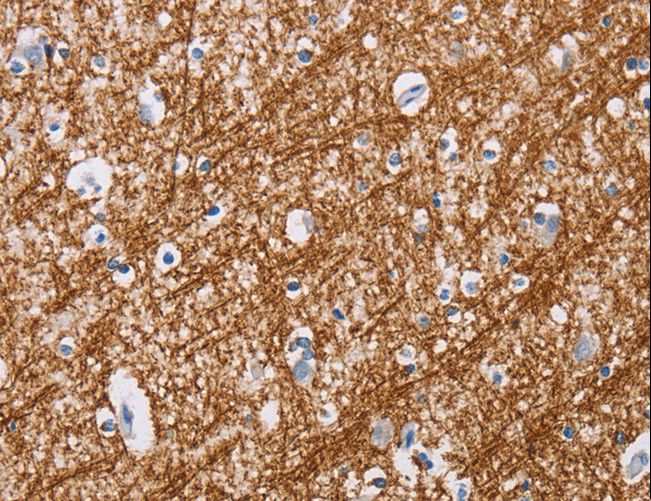 MAG Antibody - Immunohistochemistry of paraffin-embedded Human brain using MAG Polyclonal Antibody at dilution of 1:20.