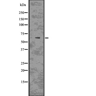 MAG Antibody - Western blot analysis of MAG using COLO205 whole lysates.