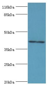 MAGE10 / MAGEA10 Antibody - Western blot. All lanes: MAGEA10 antibody at 2 ug/ml+HL-60 whole cell lysate. Secondary antibody: goat polyclonal to rabbit at 1:10000 dilution. Predicted band size: 41 kDa. Observed band size: 41 kDa.  This image was taken for the unconjugated form of this product. Other forms have not been tested.