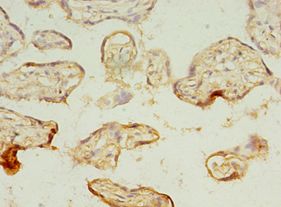 MAGE10 / MAGEA10 Antibody - Immunohistochemistry of paraffin-embedded human placenta using antibody at 1: 100 dilution.  This image was taken for the unconjugated form of this product. Other forms have not been tested.