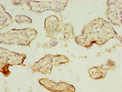 MAGE10 / MAGEA10 Antibody - Immunohistochemistry of paraffin-embedded human placenta tissue using MAGEA10 Antibody at dilution of 1:100